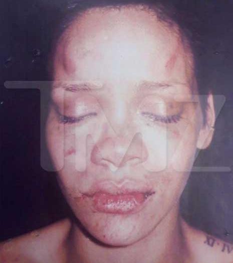rihanna chris brown beating. Rihanna Revealed After Beating