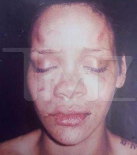 rihanna pictures after beating. rihanna after beating on